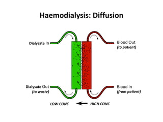 Haemodialysis: Diffusion
Dialysate In
Dialysate Out
(to waste)
Blood Out
Blood In
(to patient)
(from patient)
HIGH CONCLOW CONC
 