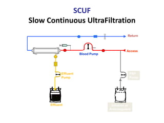 SCUF
Slow Continuous UltraFiltration
Effluent
Pump
Infusion or
Anticoagulant
Blood Pump
PBP
Pump
Effluent
Access
Return
 