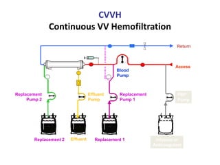 CVVH
Continuous VV Hemofiltration
Effluent
Pump
Blood
Pump
Effluent
Access
Return
Replacement
Pump 1
Replacement
Pump 2
Replacement 1Replacement 2 Infusion or
Anticoagulant
PBP
Pump
 