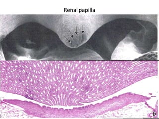 Renal papilla
 