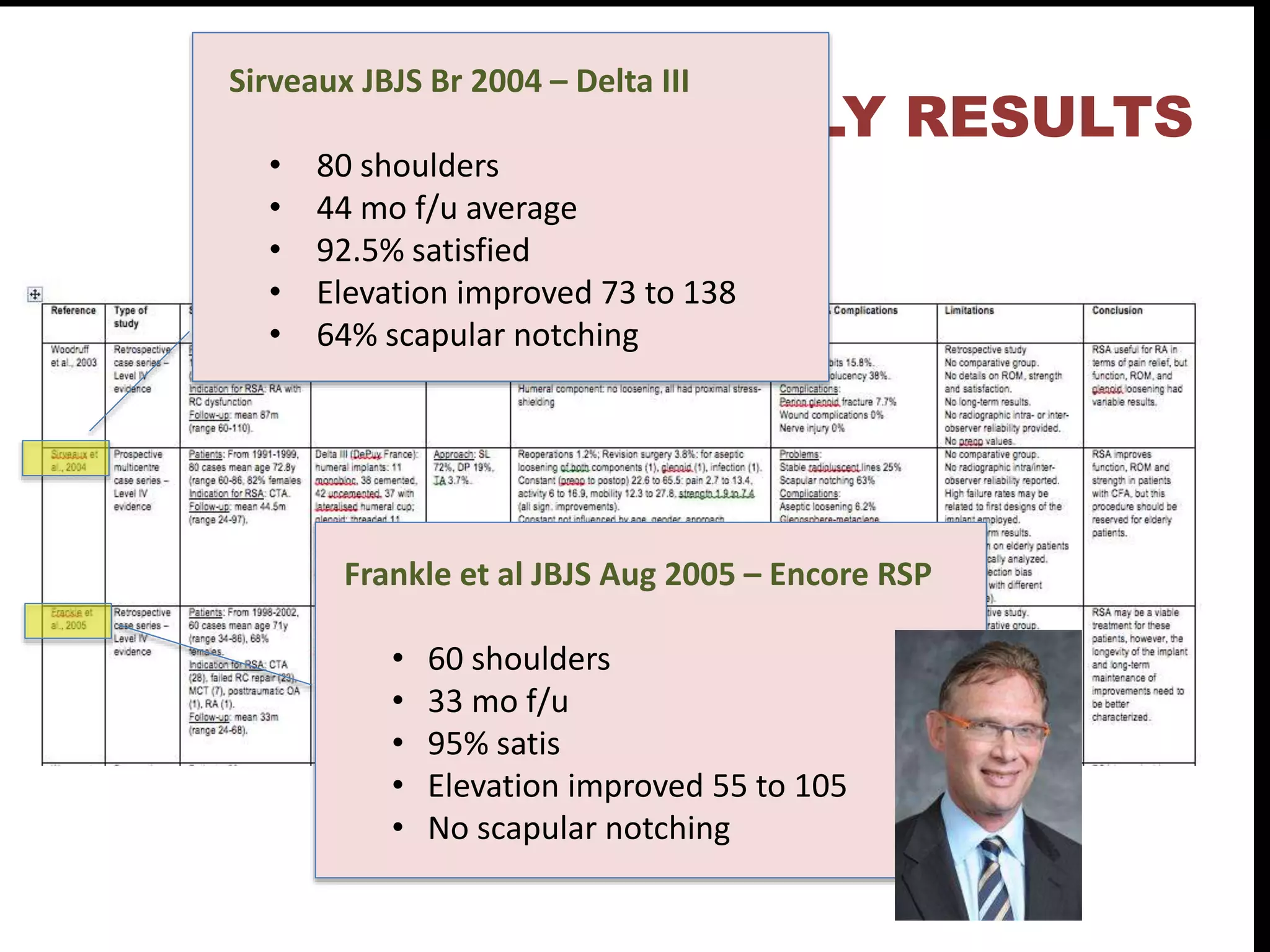 EARLY RESULTS
Sirveaux JBJS Br 2004 – Delta III
• 80 shoulders
• 44 mo f/u average
• 92.5% satisfied
• Elevation improved 73 to 138
• 64% scapular notching
Frankle et al JBJS Aug 2005 – Encore RSP
• 60 shoulders
• 33 mo f/u
• 95% satis
• Elevation improved 55 to 105
• No scapular notching
 
