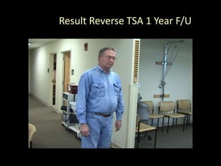 Result Reverse TSA 1 Year F/U
 