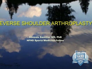 EVERSE SHOULDER ARTHROPLASTY
Gonzalo Samitier MD, PhD
HFHS Sports Medicine Fellow
 