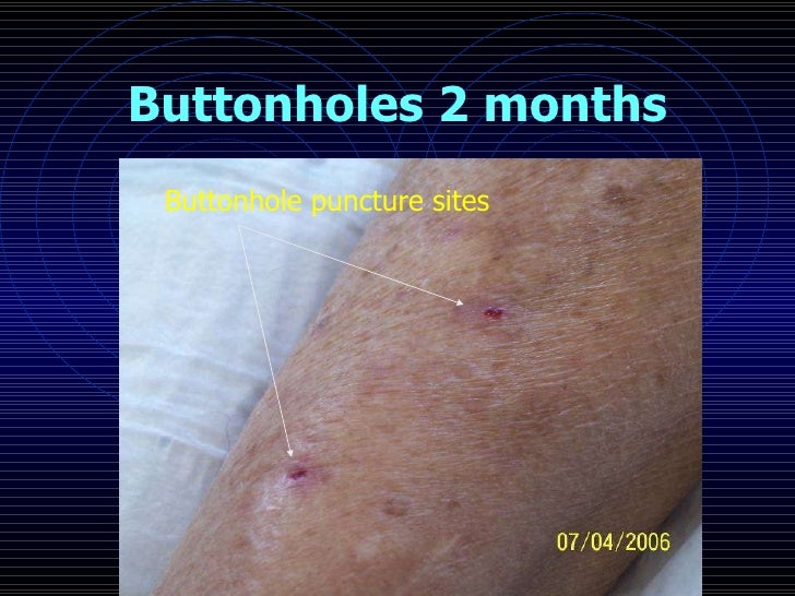 RSA buttonhole presentation 2008