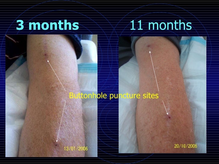 RSA buttonhole presentation 2008