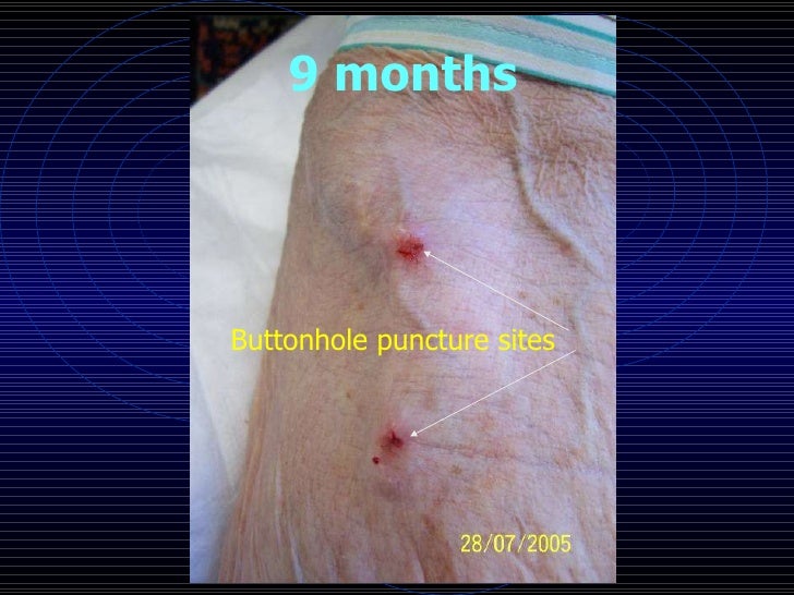 RSA buttonhole presentation 2008