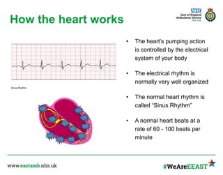 How the heart works
• The heart’s pumping action
is controlled by the electrical
system of your body
• The electrical rhythm is
normally very well organized
• The normal heart rhythm is
called “Sinus Rhythm”
• A normal heart beats at a
rate of 60 - 100 beats per
minute
Sinus Rhythm
 