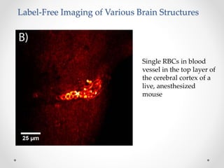 Label-free live brain imaging and targeted patching with third-harmonic ...