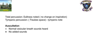Tidal percussion- Dullness noted ( no change on inspiration)
Tympanic percussion- ( Traubes space) - tympanic note
Auscultation
● Normal vesicular breath sounds heard
● No added sounds
 