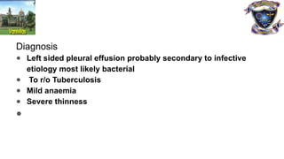 Diagnosis
● Left sided pleural effusion probably secondary to infective
etiology most likely bacterial
● To r/o Tuberculosis
● Mild anaemia
● Severe thinness
●
 