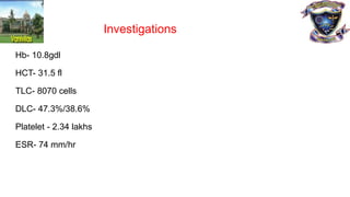 Investigations
Hb- 10.8gdl
HCT- 31.5 fl
TLC- 8070 cells
DLC- 47.3%/38.6%
Platelet - 2.34 lakhs
ESR- 74 mm/hr
 