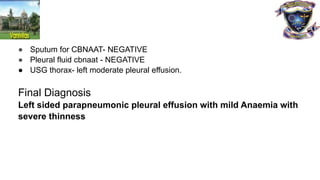 ● Sputum for CBNAAT- NEGATIVE
● Pleural fluid cbnaat - NEGATIVE
● USG thorax- left moderate pleural effusion.
Final Diagnosis
Left sided parapneumonic pleural effusion with mild Anaemia with
severe thinness
 