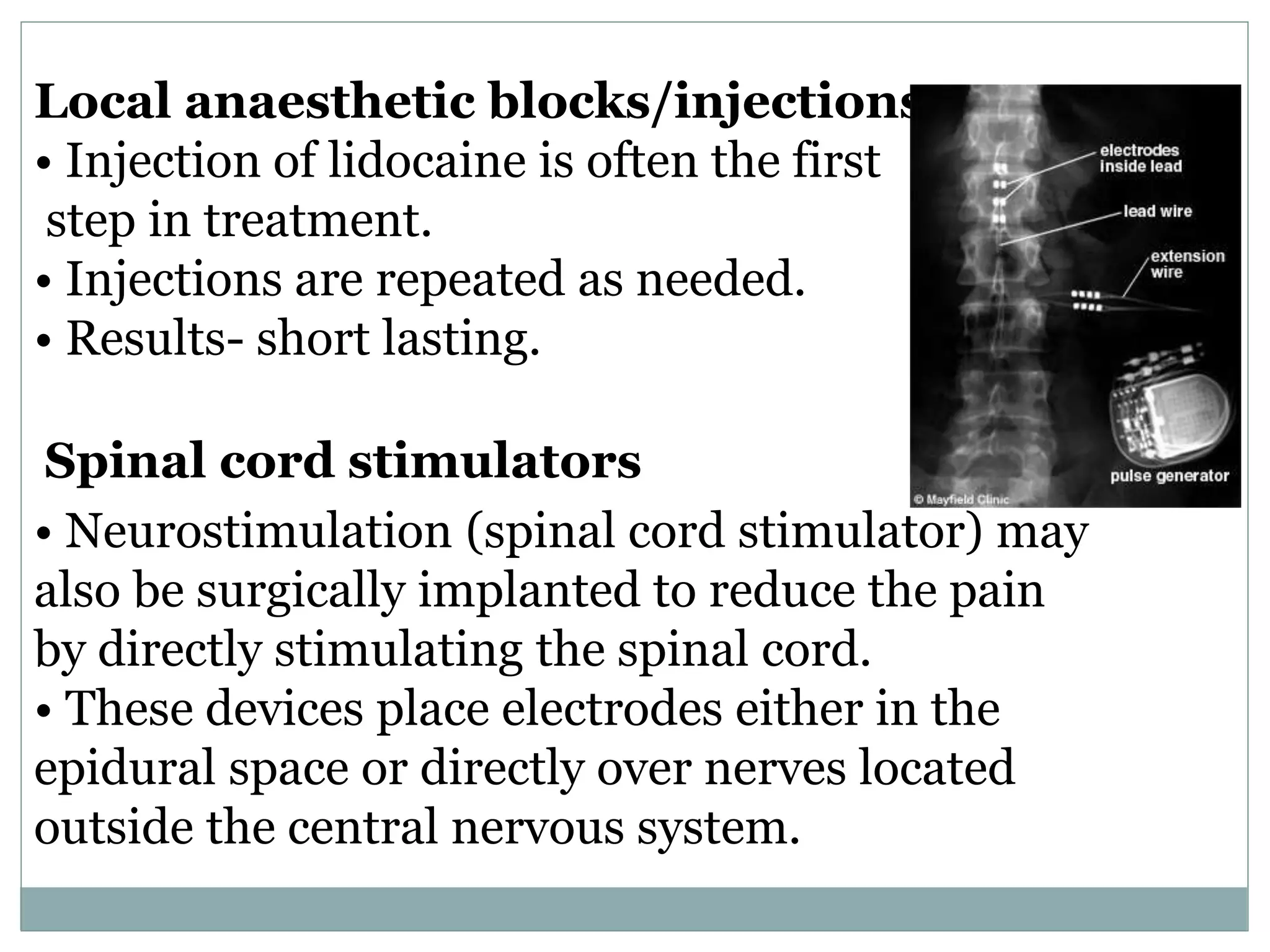 Rsd ortho | PPTX | Brain and Nervous System Disorders | Diseases and ...