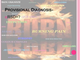 PROVISIONAL DIAGNOSIS-
RSD=?
 