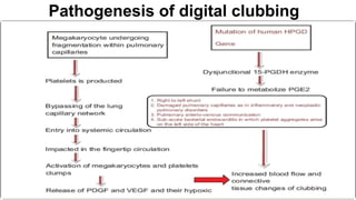 Clubbing Pathophysiology Notes Rs examination casesheet format for pg exams | PPTX