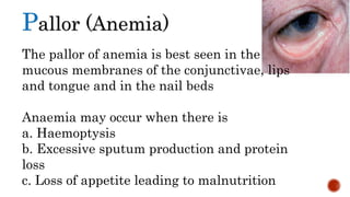 Pallor (Anemia)
The pallor of anemia is best seen in the
mucous membranes of the conjunctivae, lips
and tongue and in the nail beds
Anaemia may occur when there is
a. Haemoptysis
b. Excessive sputum production and protein
loss
c. Loss of appetite leading to malnutrition
 