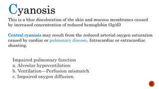 Cyanosis
This is a blue discoloration of the skin and mucous membranes caused
by increased concentration of reduced hemoglobin (5g/dl)
Central cyanosis may result from the reduced arterial oxygen saturation
caused by cardiac or pulmonary disease. Intracardiac or extracardiac
shunting.
Impaired pulmonary function
a. Alveolar hypoventilation
b. Ventilation—Perfusion mismatch
c. Impaired oxygen diffusion.
 
