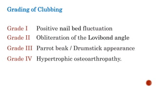 Grading of Clubbing
Grade I Positive nail bed fluctuation
Grade II Obliteration of the Lovibond angle
Grade III Parrot beak / Drumstick appearance
Grade IV Hypertrophic osteoarthropathy.
 