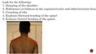 Look for the following:
1. Drooping of the shoulder
2. Hollowness or fullness in the supraclavicular and infraclavicular fossa
3. Crowding of ribs
4. Kyphosis (forward bending of the spine)
5. Scoliosis (lateral bending of the spine).
 