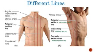 Different Lines
 