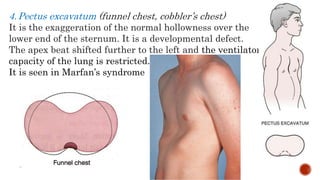4.Pectus excavatum (funnel chest, cobbler’s chest)
It is the exaggeration of the normal hollowness over the
lower end of the sternum. It is a developmental defect.
The apex beat shifted further to the left and the ventilatory
capacity of the lung is restricted.
It is seen in Marfan’s syndrome
 