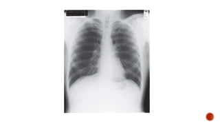 Clinical Examination of RS