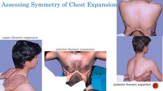 Assessing Symmetry of Chest Expansion
anterior thoracic expansion
upper thoracic expansion
posterior thoracic expantion
 