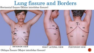 Lung fissure and Borders
Oblique fissure (Major interlobar fissure)
Horizontal fissure (Minor interlobar fissure)
T2
 