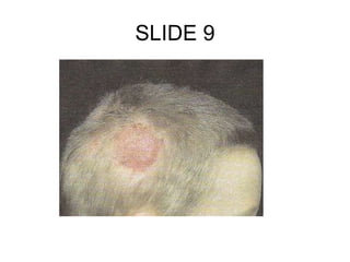 SLIDE 9
 
