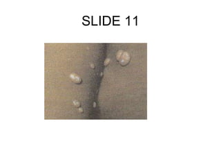 SLIDE 11
 
