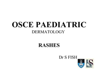 OSCE PAEDIATRIC
DERMATOLOGY
RASHES
Dr S FISH
 