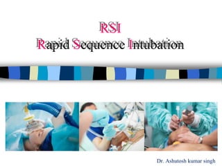 Dr. Ashutosh kumar singh
RSI
Rapid Sequence Intubation
 