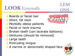 LOOK Externally
 Beards or facial hair
 Short, fat neck
 Morbidly obese patients
 Facial or neck trauma
 Broken teeth (can lacerate balloons)
 Dentures (should be removed)
 Large teeth
 Protruding tongue
 A narrow or abnormally shaped face
LEM
ONS
 