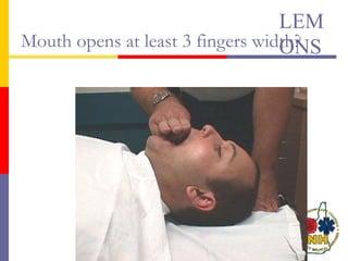 Mouth opens at least 3 fingers width?
LEM
ONS
 