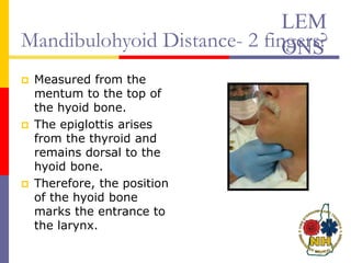 Mandibulohyoid Distance- 2 fingers?
 Measured from the
mentum to the top of
the hyoid bone.
 The epiglottis arises
from the thyroid and
remains dorsal to the
hyoid bone.
 Therefore, the position
of the hyoid bone
marks the entrance to
the larynx.
LEM
ONS
 