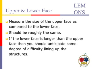 Upper & Lower Face
 Measure the size of the upper face as
compared to the lower face.
 Should be roughly the same.
 If the lower face is longer than the upper
face then you should anticipate some
degree of difficulty lining up the
structures.
LEM
ONS
 