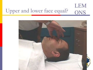 Upper and lower face equal?
LEM
ONS
 