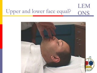 Upper and lower face equal?
LEM
ONS
 