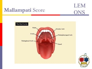 Mallampati Score
LEM
ONS
 