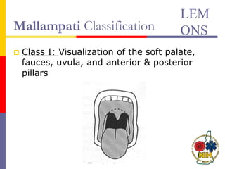 Mallampati Classification
 Class I: Visualization of the soft palate,
fauces, uvula, and anterior & posterior
pillars
LEM
ONS
 