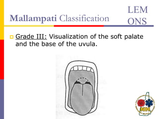 Mallampati Classification
 Grade III: Visualization of the soft palate
and the base of the uvula.
LEM
ONS
 