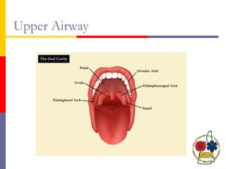 Upper Airway
 