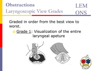 Obstructions
Laryngoscopic View Grades
Graded in order from the best view to
worst.
 Grade 1: Visualization of the entire
laryngeal apeture
LEM
ONS
 