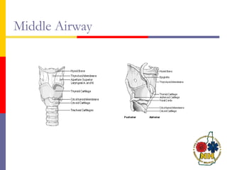 Middle Airway
 