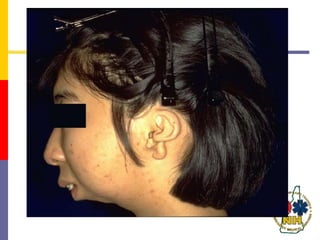 iairwayassessment.ppt