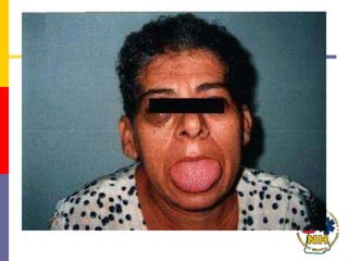 iairwayassessment.ppt