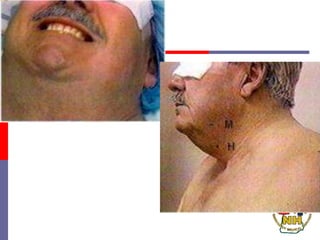 iairwayassessment.ppt