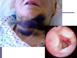 iairwayassessment.ppt