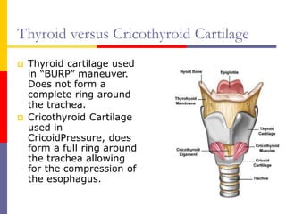 Thyroid versus Cricothyroid Cartilage
 Thyroid cartilage used
in “BURP” maneuver.
Does not form a
complete ring around
the trachea.
 Cricothyroid Cartilage
used in
CricoidPressure, does
form a full ring around
the trachea allowing
for the compression of
the esophagus.
 
