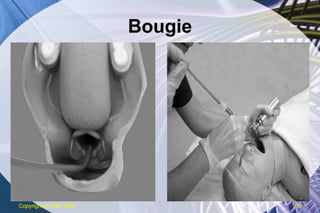 Bougie Copyright  © 2007 ENA 